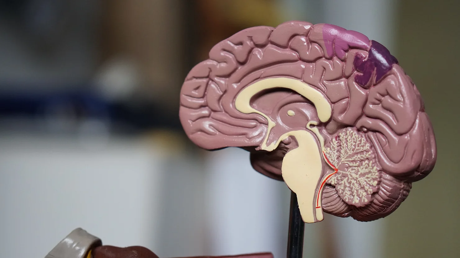 Parkinson's Disease and Associated Gut Dysfunction